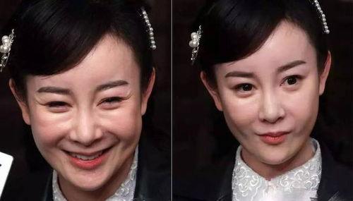 明星里面没整容的有谁,揭秘未整容的明星风采